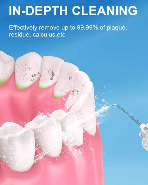MySmile 10 PCS Replacement Jet Tips, Oral Irrigator Nozzle Set Compatible with Waterpik, Includes Classic, Periodontal