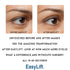 Original Eye Lift Kit, Small/Medium Size with Gel, Lifts Eyelid Droop and Hooded Eyes
