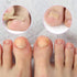Ingrown Toenail Correction Patch, 50 Pcs Glue-free Stickers for Professional Foot Care