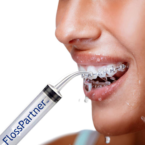 FlossPartner Dental Pick Water Flosser. Smallest Cordless Portable Pocket Size. Easy Carry. Teeth Gums Breath and BRACES. Effective Reusable. Travel School Camping Survival Tool