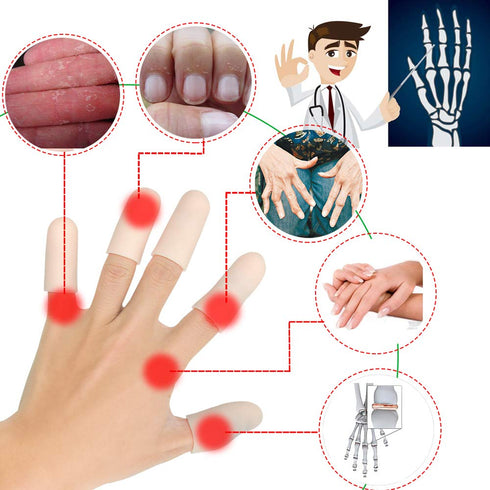 Gel Finger Cots, 14 PCS Finger Protector Support for Trigger Finger, Hand Eczema, and Arthritis (Beige, Short)