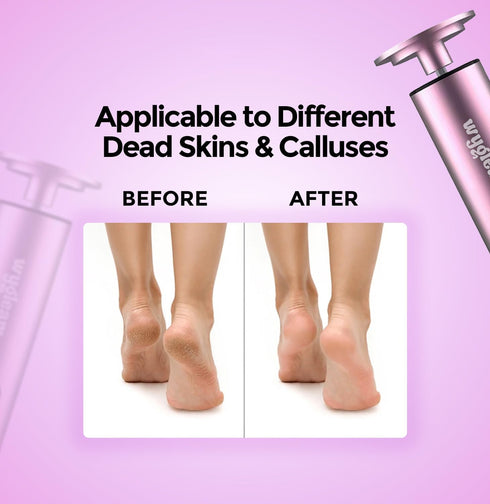 WYGLEAM 2 1 3 Electric Callus Remover for Feet & Nail File Drill Kit - in Rechargeable Pedicure Tools for Flawless Feet