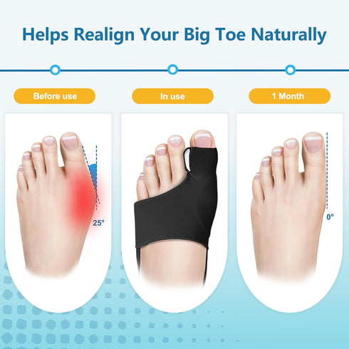 ZRCZRC 2-Pack Bunion Corrector for Women Big Toe, Big Toe Straightener, Instant Pain Relief, Wide Non-slip Strap