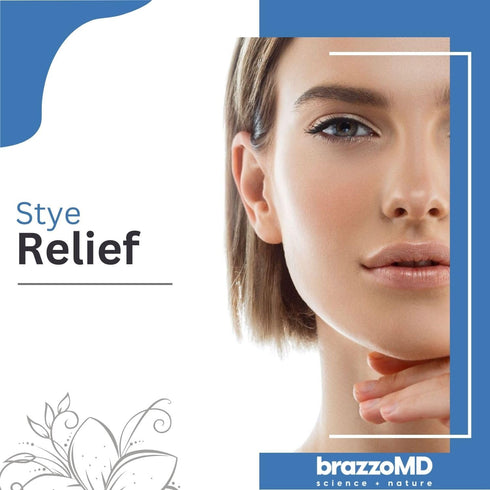 brazzoMD Stye Relief - Physician-formulated with Arnica & Calendula, 1.0 Fl Oz