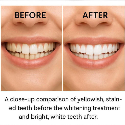 Perlia 7-Day (14 Teeth Whitening Strips, Sensitivity-Free, Enamel Safe, Treatment Strips) with Tea Tree Oil, Coconut