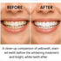 Perlia 7-Day (14 Teeth Whitening Strips, Sensitivity-Free, Enamel Safe, Treatment Strips) with Tea Tree Oil, Coconut