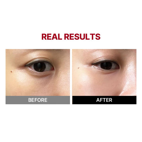 Mega Under Eye Masks (4 Pairs) | Wrinkle-Fit Tangle Eye Patch | Korean Eye Mask for Puffiness, Dark Circles,