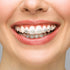 BVN Braces Wax Dental Wax: 20 Boxes of Orthodontic Wax Strips, Relief Wax for Braces Wearers, Oral Wax for Teeth