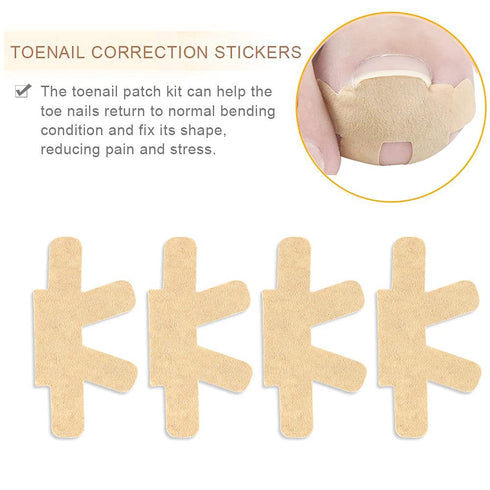 Ingrown Toenail Correction Stickers, 16 Pcs Thick Paronychia Corrector Patches for Nail Healing Care