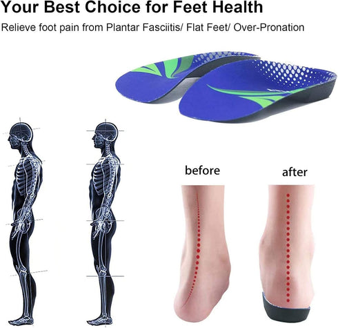 RooRuns FitFeet Orthotic Inserts 3/4 Length - High Arch Support Insoles for Over-Pronation, Plantar Fasciitis