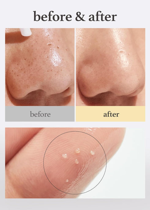 NOONI Korean Facial Oil Cleanser - 200ml Snow Aqua Toning Cleansing Oil for Double Cleansing
