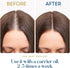 Herbsindia 3.3 Oz 100% Rosemary Essential Oil for Hair - Huge Fl - Pure - Premium Grade with Glass Dropper, Undiluted