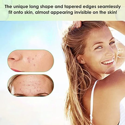 Large Blemish Patches - 22 XL Hydrocolloid Strips, Zit Stickers for Face, Facial Skin Care