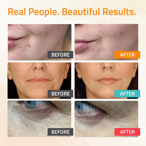 YEOUTH Retinol Serum for Face, Vitamin C & Hyaluronic Acid Serum Set for Women, Skin Care 3x1 oz