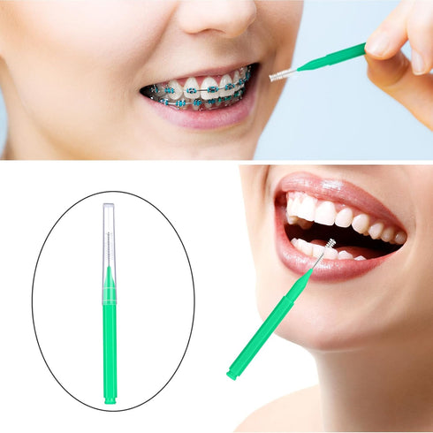 Patelai 100 Pieces Braces Brush for Cleaner Interdental Brush Toothpick Dental Hygiene Flosser (Green)