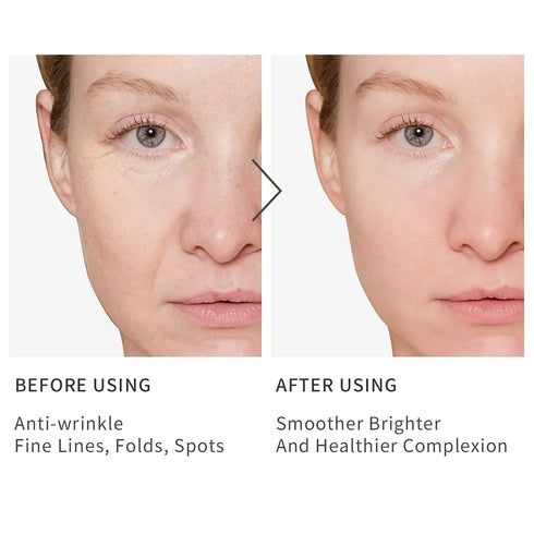Vitamin C Serum for Face, Anti Aging Serum with Hyaluronic Acid, Reduces Wrinkles, Dark Spot Remover for Women