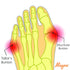 Bunion Corrector for Women & Men, Big Toe Pain Relief, Hallux Valgus Splint Pads & Cushion Guards