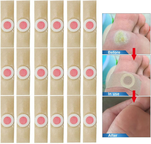 FOMIYES 72 Pcs Corn Remover Pads, Self-Stick Adhesive Foot Care Cushions for Pain Relief, Pink Toe Pads