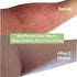 Eczema Pill – Natural Treatment for Eczema, Dermatologist Developed, 7 All Natural Minerals