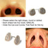 WoodyKnows Ultra-Breathable Nasal Filters, 6 Pack for Seasonal and Dust Allergies (Narrow, XL)