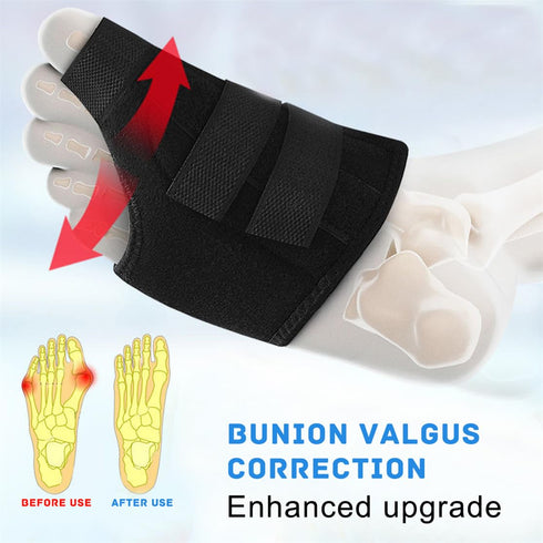 Bunion Corrector for Women and Men - Adjustable Orthopedic Splint, 2 Pcs Bunion Pads for Hallux Valgus Pain Relief