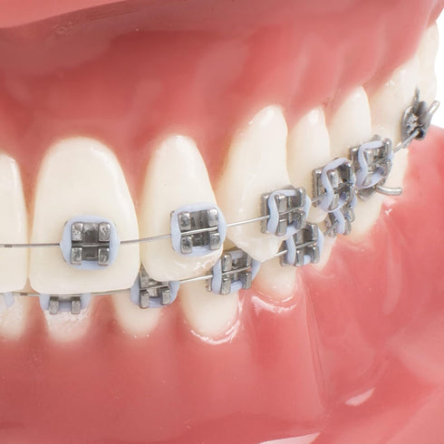 TM-208 Demonstration Orthodontic Model Teeth with Metal and Ceramic Bracket (Red)