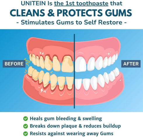 Gum Restore Toothpaste, Improves and protects damaged & bleeding gums, Breaks Down Plaque, Resists Tarter, Plant-based Formula, 99% Natural Ingredients, Free of Fluoride, Triclosan, Microbeads