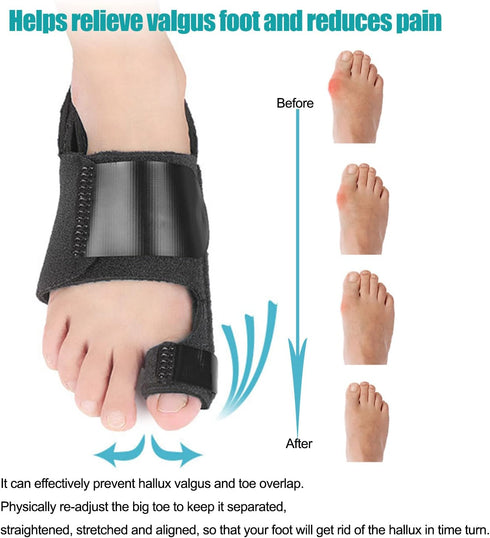 Bunion Corrector and Splint, Orthopedic Bunion Relief for Hallux Valgus Pain, Fits Men and Women
