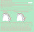 Comfort Cover for Braces, Lip Protector Mouth Guard, Teeth Shield Bumper for Brackets and Aligners