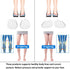 Medial & Lateral Heel Wedge Silicone Insoles, Supination & Pronation Corrective Gel Adhesive Shoe Inserts for Foot