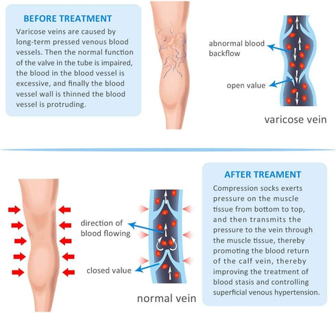 XUANSHOW 20-30mmHg Compression Pantyhose for Women, Medical Compression Stockings, High Waist Opaque Compression Tights