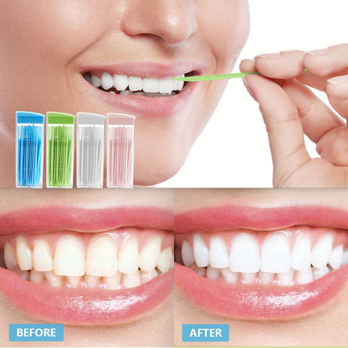 Plastic Toothpicks Disposable Interproximal Brush, Sturdy Double-Ended Dental Pick, 200Pcs Random Color.