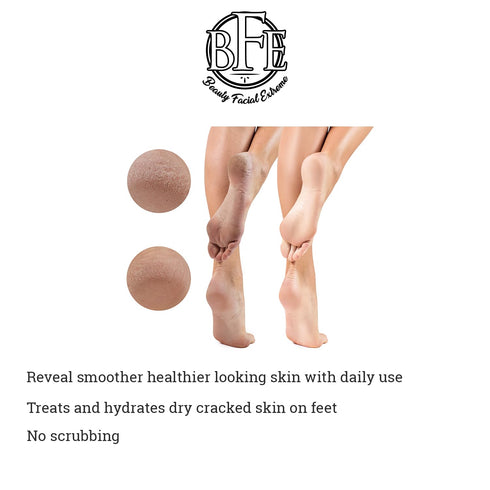 Keratosis Pilaris Exfoliating Body Lotion – 12% Lactic Acid for Gentle Exfoliation & Moisture