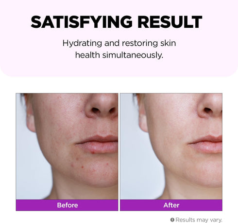 Superfood for Skin Hyalusteen Repair Toner 5.07fl.oz, 150ml - Facial Hydrating Toner for Soothing