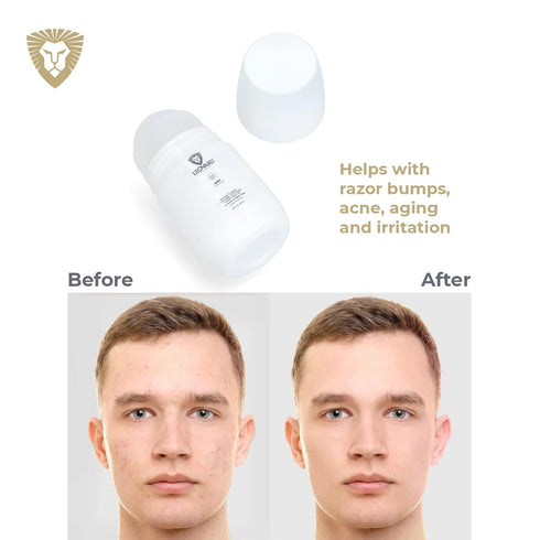 Leovard Men & Women Razor Bump Serum Roll-On for Ingrown Hairs, Razor Bumps, Irritation, Blemishes