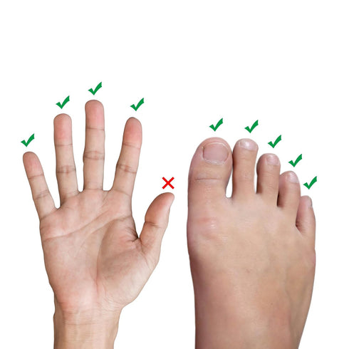 Happiby 10 Jammed, Finger Buddy Wraps, PCS Finger Loops Tapes for Broken, Swollen or Dislocated Joint, Splints Brace