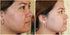 Judith August The Everything Pencil Deluxe, Neutral, Erase Zit