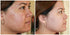 The EraseZit Pencil Deluxe, Neutral Light