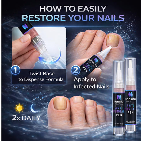 NOORISH FOOT CO. 2 Nail Fungus Treatment Pen for Toenails & Fingernails - Antifungal Nail Repair with Undecylenic Acid