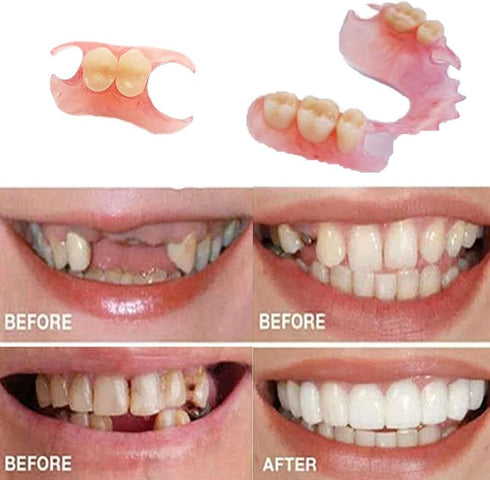 Do It Yourself Fake Tooth Repair Kits or Making Temporary Partial or Full Dentures,Tooth Fixing Kit for regaining Condident Smile