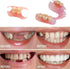 Do It Yourself Fake Tooth Repair Kits or Making Temporary Partial or Full Dentures,Tooth Fixing Kit for regaining Condident Smile