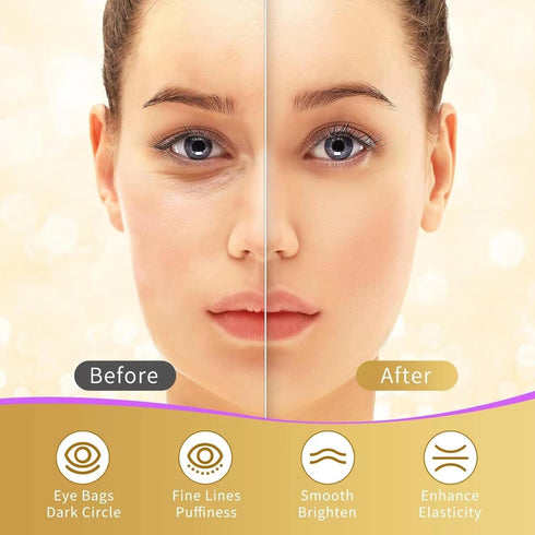 Under Eye Patches, 40 Pairs for Dark Circles, Puffy Eyes, Wrinkles, with 24K Gold, Hyaluronic Acid & Rose