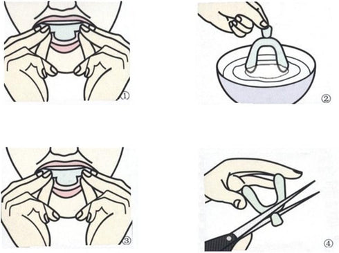5 Pieces Teeth Whitening Trays, Whitener Mouth Guard, Oral Hygiene Bleaching Tooth Tool for Whitening Teeth Care