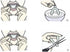 5 Pieces Teeth Whitening Trays, Whitener Mouth Guard, Oral Hygiene Bleaching Tooth Tool for Whitening Teeth Care
