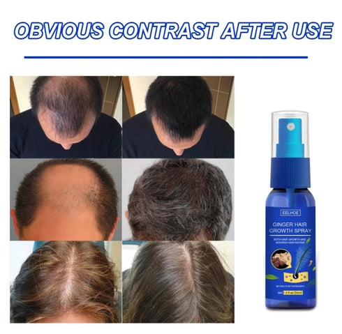 Ginger Hair Growth Spray | Promotes Thicker, Longer Hair with Ginger Extract for Scalp Moisturization and Regrowth