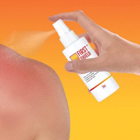 First Aid Burn Spray, Topical Numbing Spray with Lidocaine for Pain and Itch Relief of Minor Scalds and Burns – 2 Oz