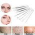 Pinkiou Blackhead Removers | 8-in-1 Acne Extractor Tool Kit for Face and Nose | Blemish Removal Skincare