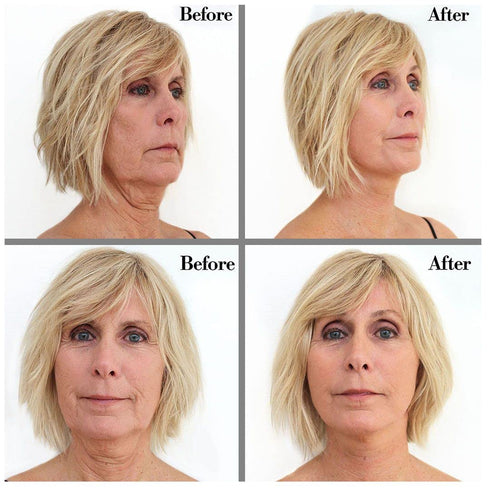 Instant Face Lift Tape Kit - 30-Day Supply of Transparent Neck & Eyebrow Lift Strips - Made in USA