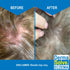 Pack) Eczema Shampoo & Conditioner (Combo - Flare Control Scalp & flake Relief Therapy that Protects, Moisturizes