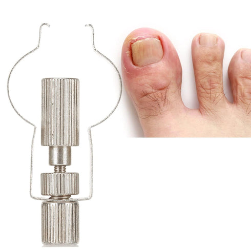 Ingrown Toenail Lifter Tool, Stainless Steel Clamp for Ingrown Toenail Care, Professional Foot Care Tool, Silver